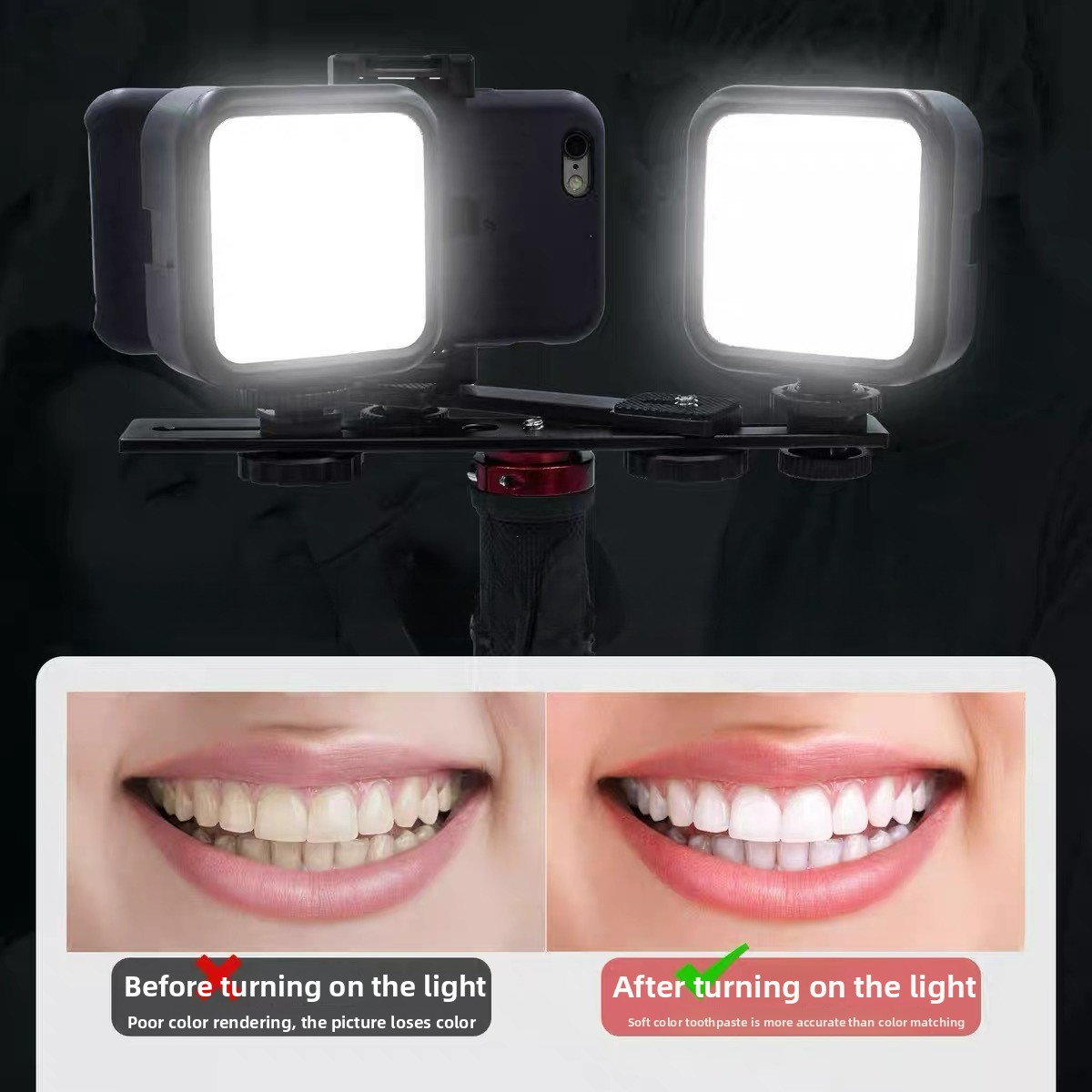 Photography Basic - Bluetooth Özellikli Diş Fotoğrafçılığı Işığı, Oral
